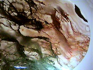 agate_moss320.jpg, 24059 bytes, 9/4/00